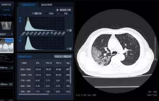 凯发k8调整新冠病毒肺炎确诊程序